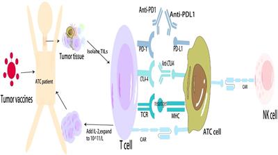 Research progress of immunotherapy against anaplastic thyroid cancer